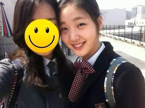 单眼皮怎么整容变双眼皮,嫌弃自己双眼皮小怎么办