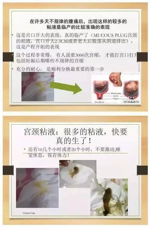 张宏玉教授呼吁:除非有紧急医学情况,否则不要提前选择剖宫产!
