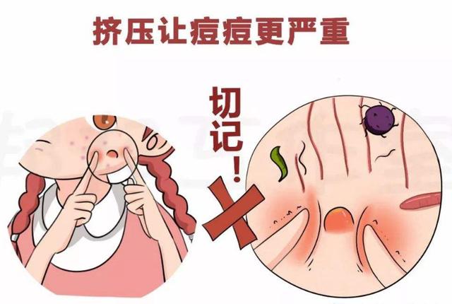 脸上痘痘红肿硬块痛怎么快速消除,脸上长很大的痘痘很痛很硬