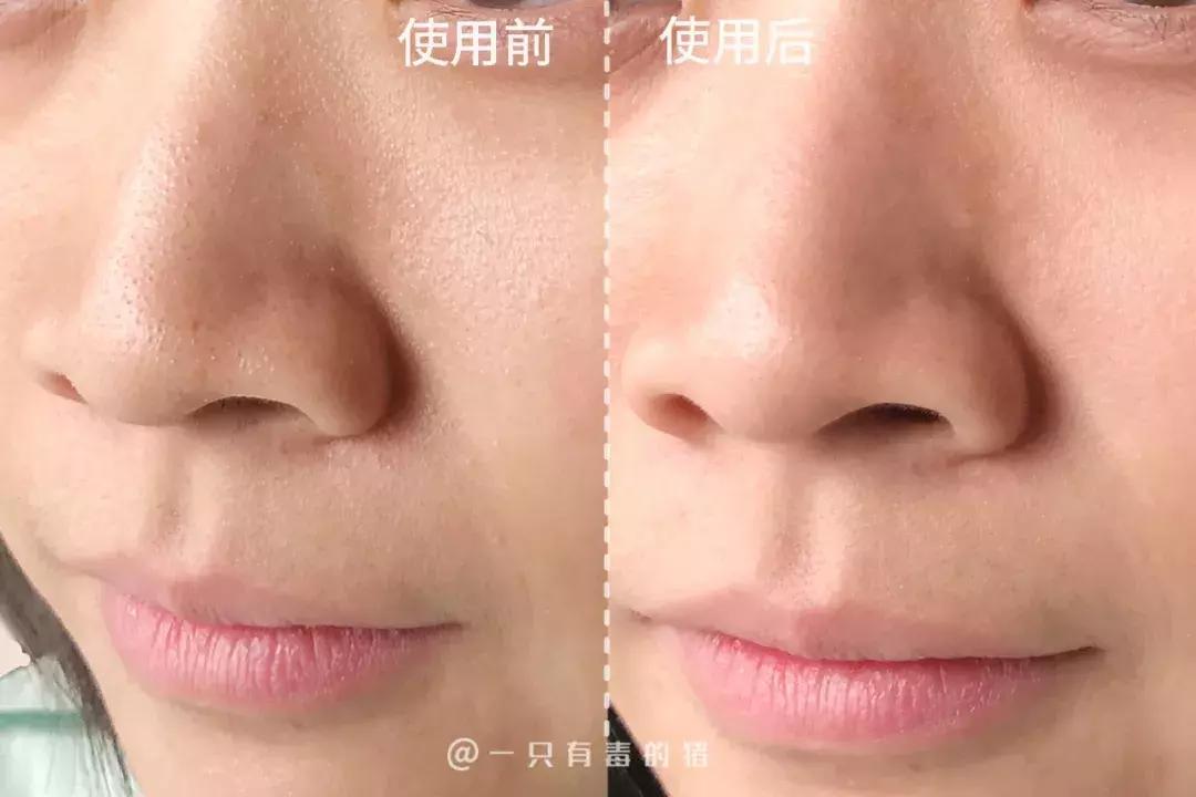 网红面膜清洁面膜,网红同款清洁面膜美白