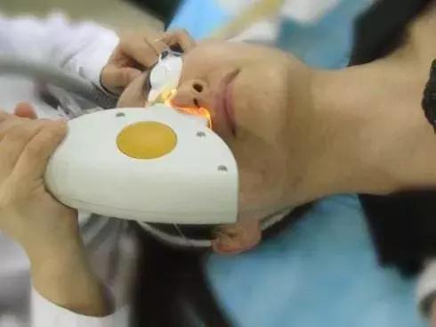 光子嫩肤微针,微针光子嫩肤