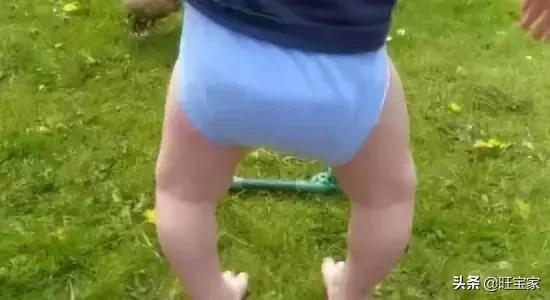 林允儿天使照,林允儿o型腿怎么变直的