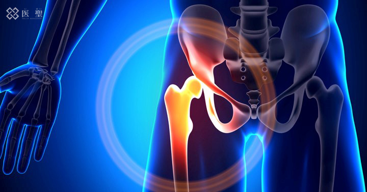 干细胞回输能治疗股骨头坏死吗,造血干细胞治疗股骨头坏死