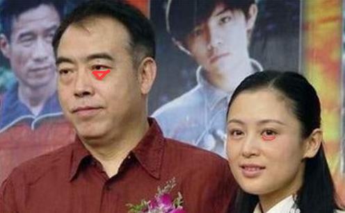 卧蚕和眼袋的区别你知道吗,眼袋和卧蚕的区别在哪里