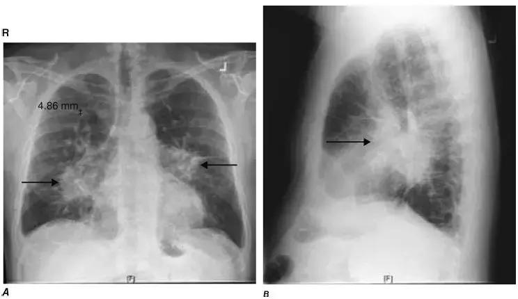胸部影像解剖图谱书,胸部断层图谱