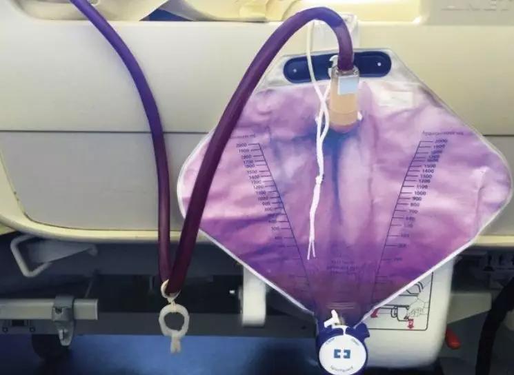 男子生殖器自燃的新闻,男性生殖器着火