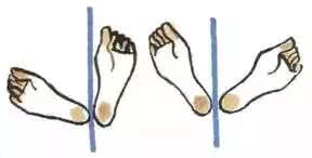 拉伸脖子会让斜方肌越来越大吗,脖子两侧肌肉变粗的方法