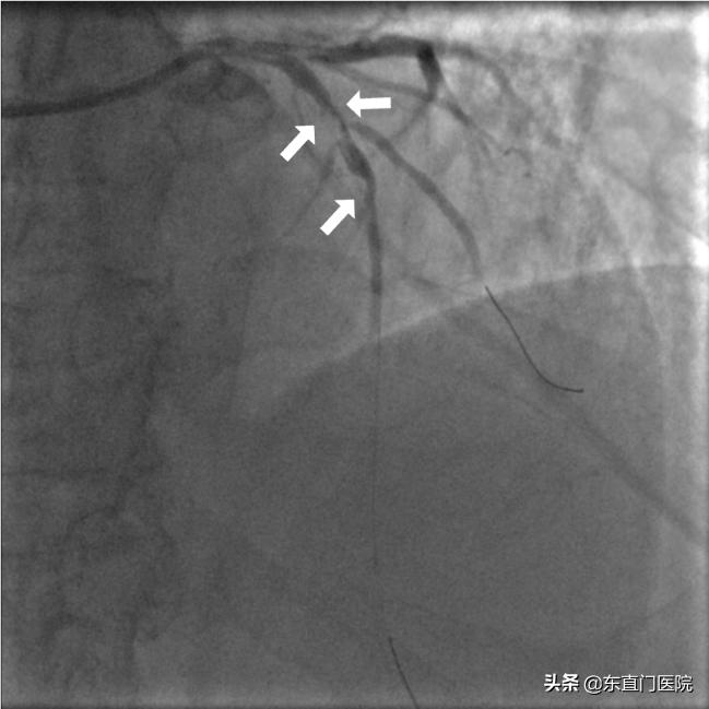精确规范力挽狂澜
