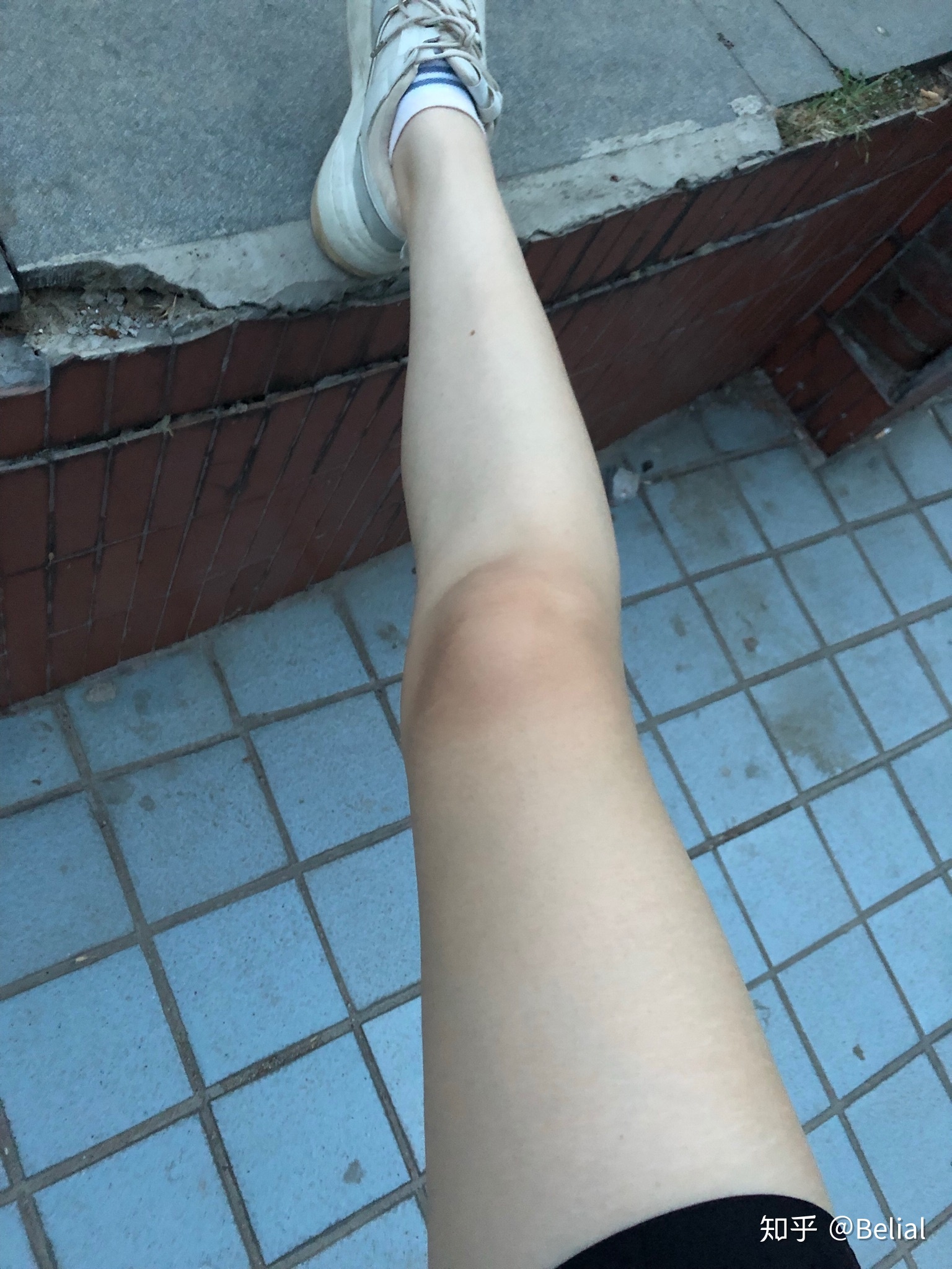 快速见效的美白方法不花钱,美白有效方法0成本