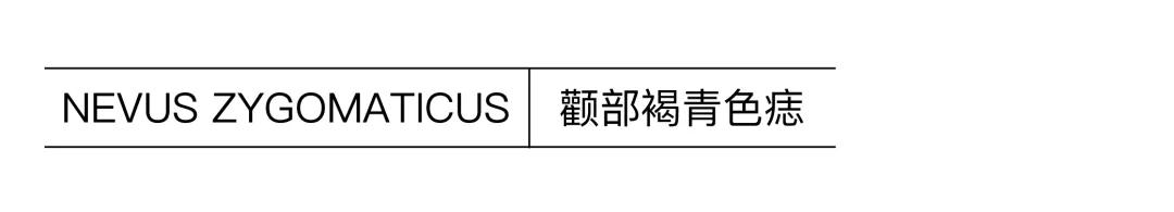 色斑皮肤问题及护肤解决方法,色斑护肤知识