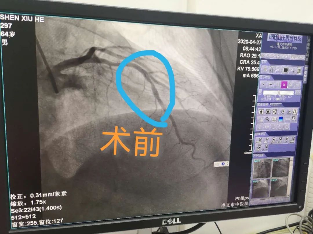 襄阳市中医院心病科,心病科科室介绍