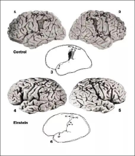 爱因斯坦大脑和平常人大脑对比,爱因斯坦大脑与正常人大脑的区别