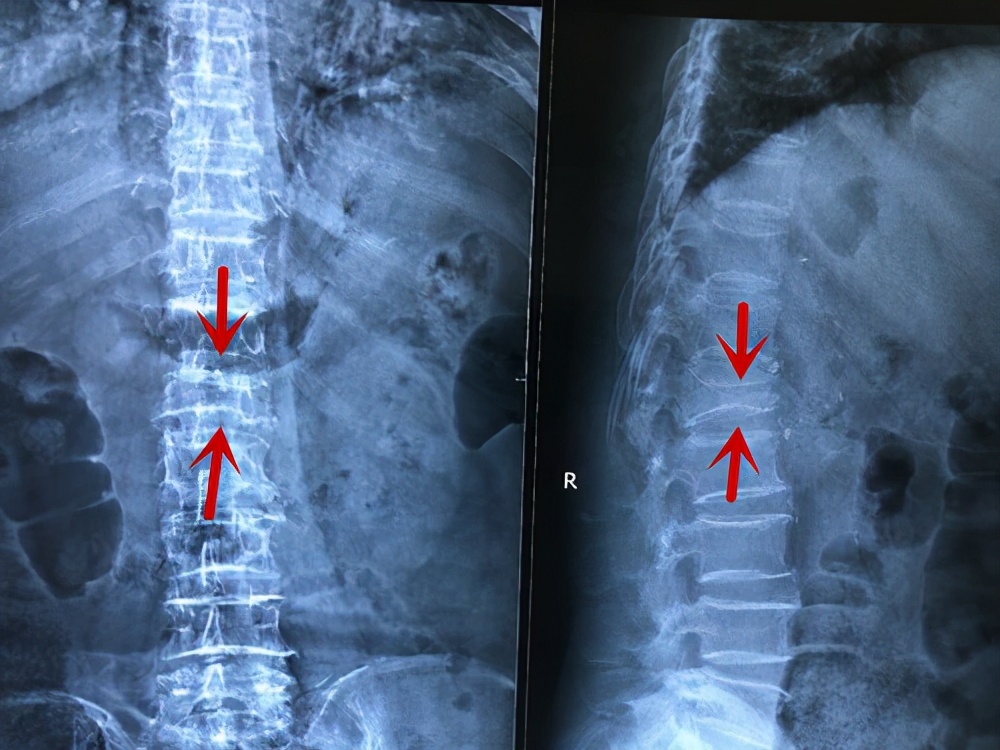 翻身痛坐起来也痛是怎么回事呀,呼吸翻身疼痛是什么原因
