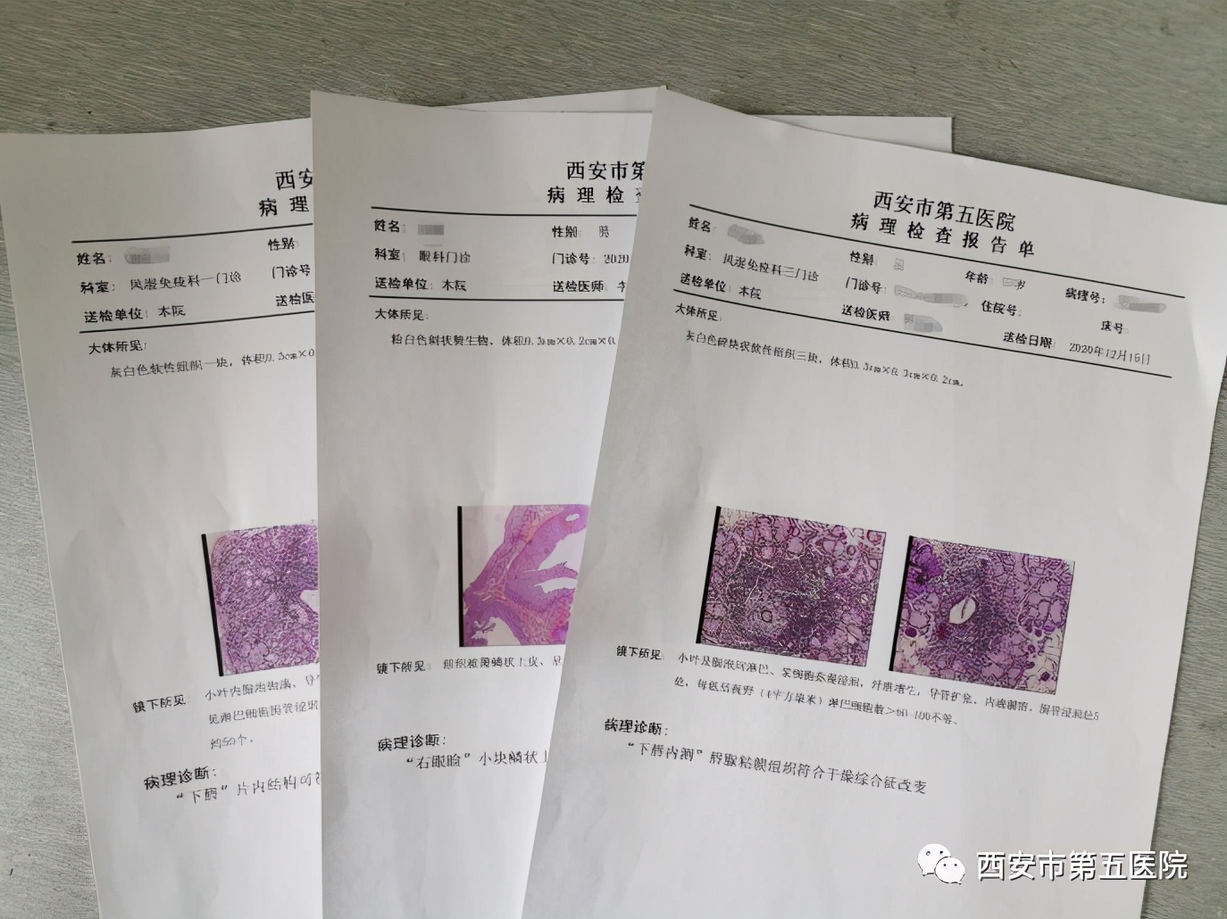 穿刺病理分析为什么那么慢,快病理和慢病理有啥区别