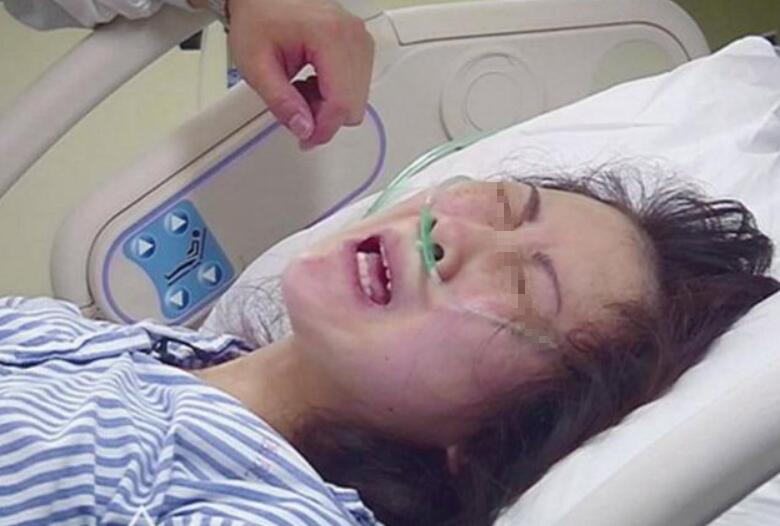 剖腹产和顺产到底该如何选择,剖腹产比较好还是顺产比较好