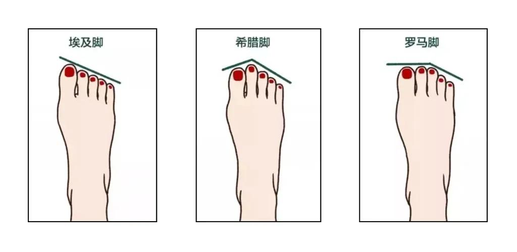 夏天穿凉鞋的季节，不懂脚型，选错鞋子又丑又磨脚！