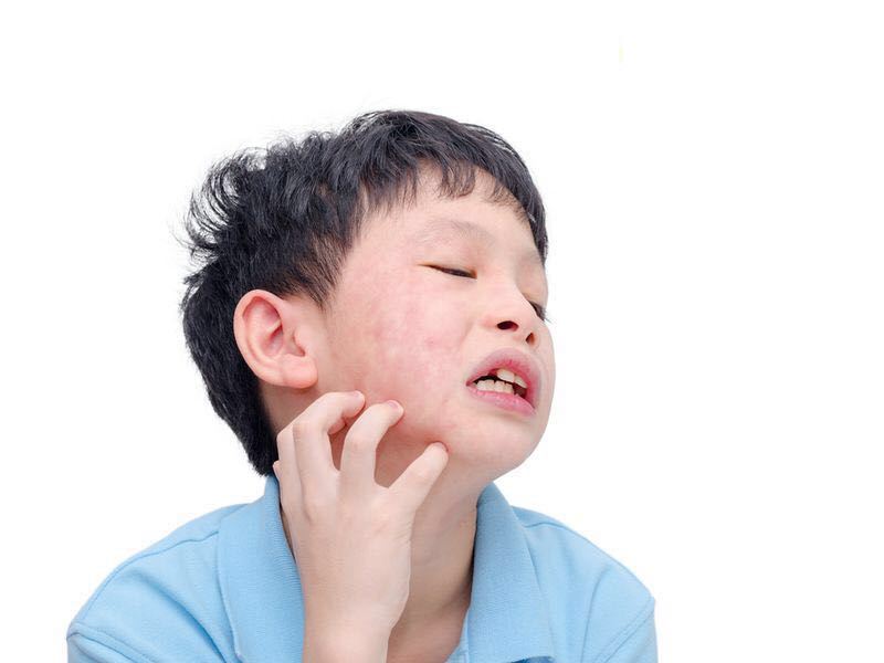 3岁宝宝身上痒,孩子出现难以忍受的痒感