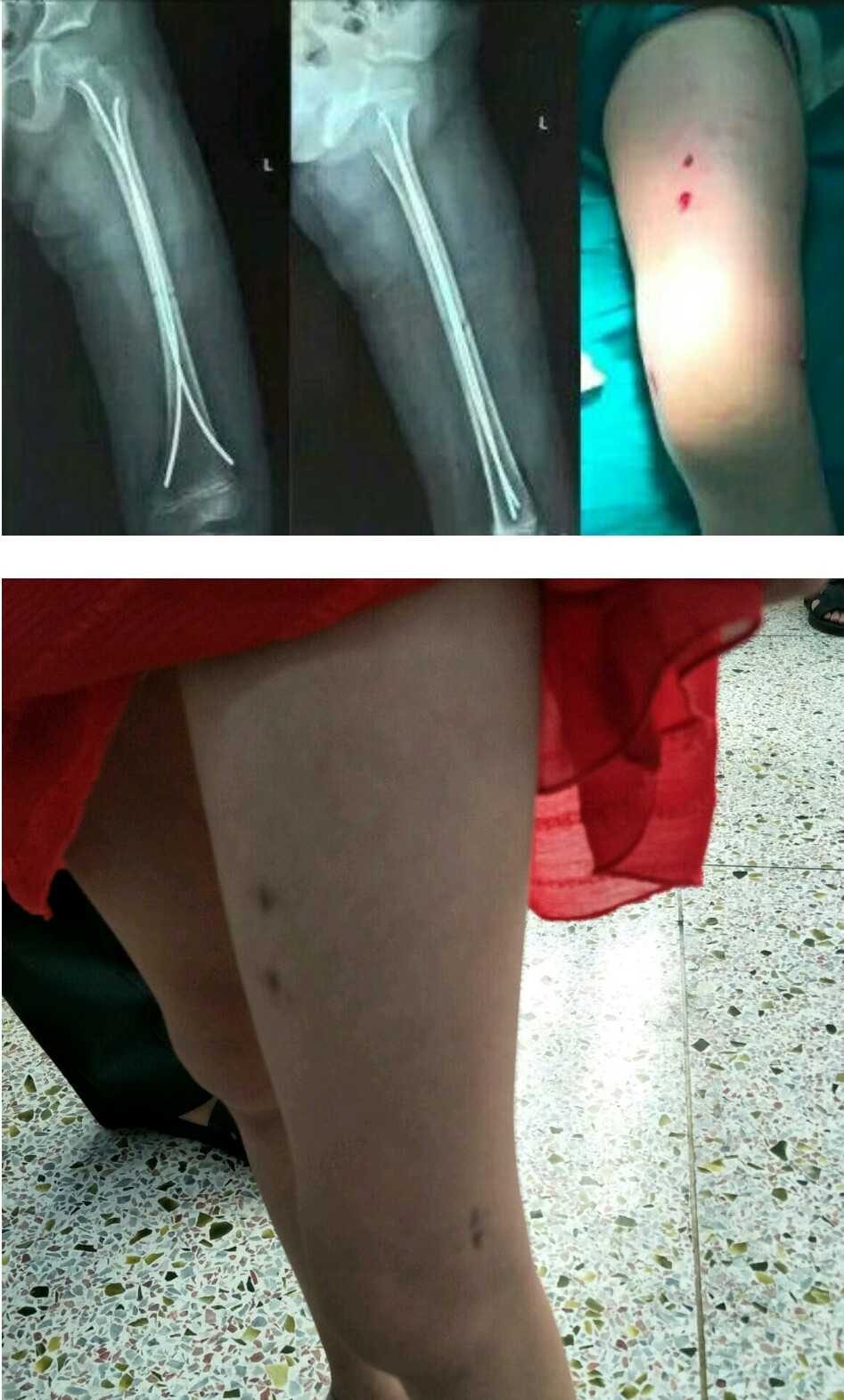 邱医生手术,邱医生祛疤