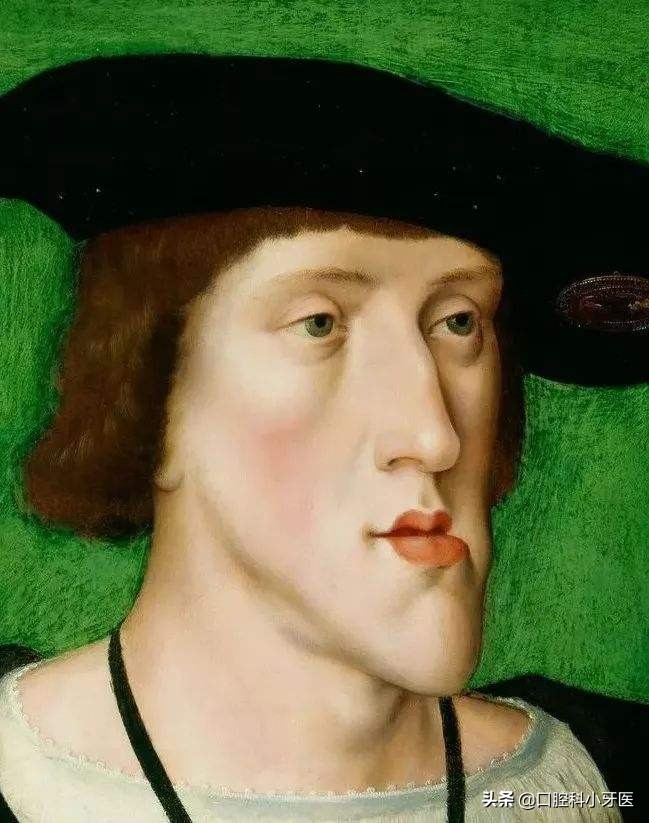 牙医的良心忠告牙齿矫正,别急着牙齿矫正先弄懂这10件事