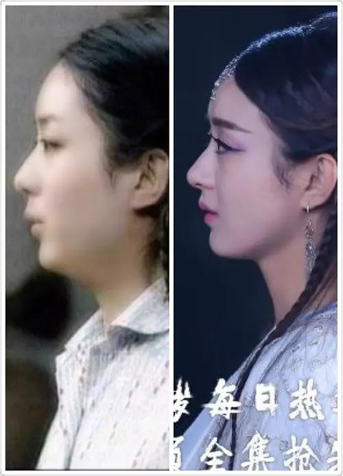 赵丽颖佳雪广告多少钱,十年前的佳雪广告