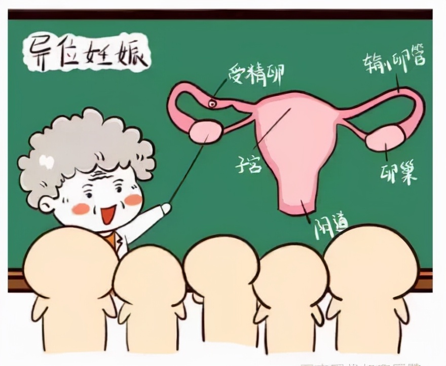 家属不解：宫外孕术后为何要口服流产药