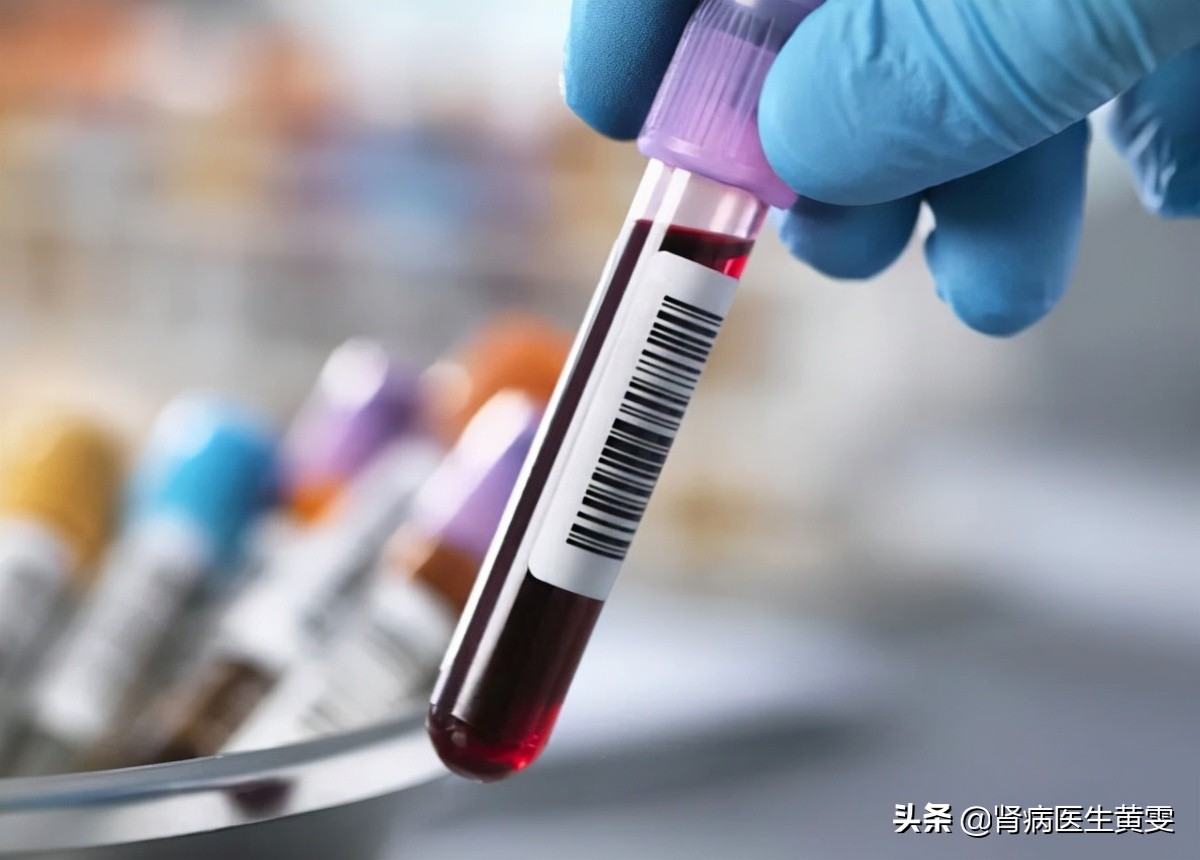 肾肌酐高到多少需透析,肾透析降肌酐的最好方法
