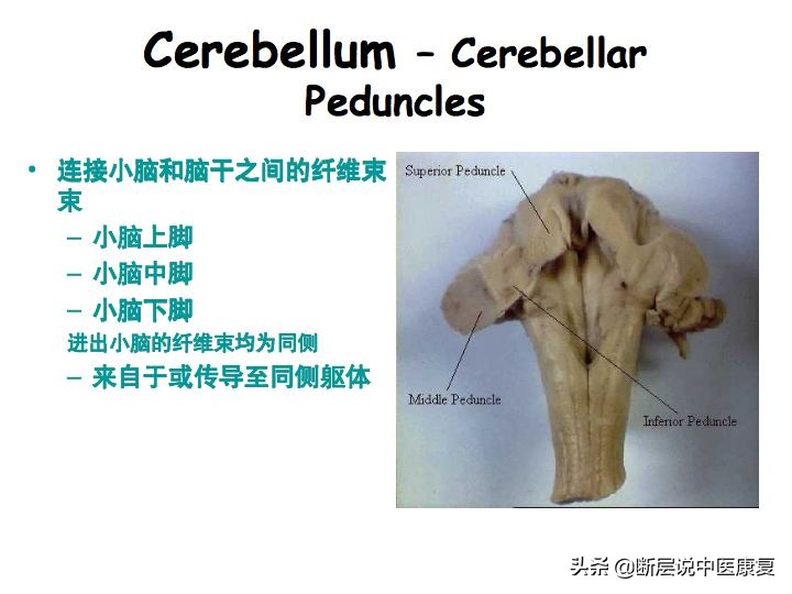 中枢神经系统断层解剖讲解,中枢神经3d解剖动画