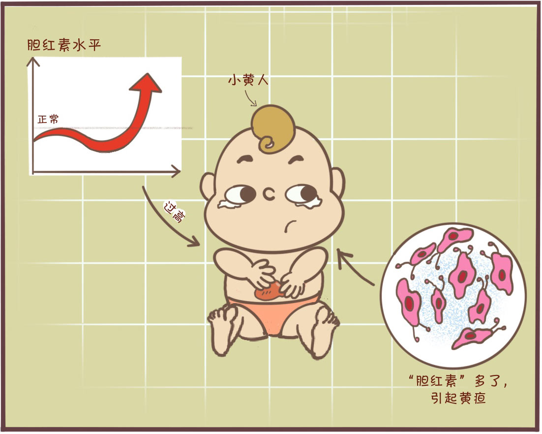 黄疸18不照黄疸晒太阳可以吗,急性黄疸肝炎晒太阳能退黄疸吗