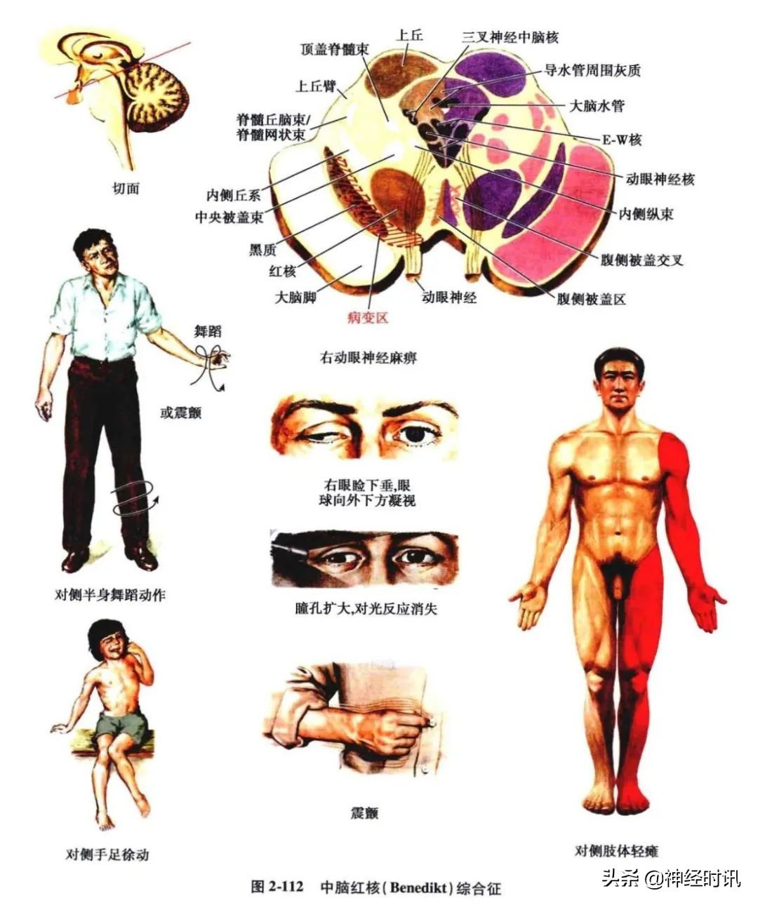 脑干解剖,脑干神经解剖