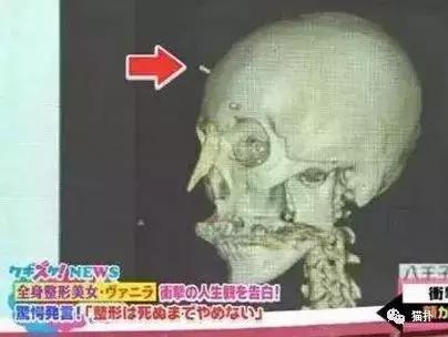 日本妹子花1286万元整容成芭比娃娃?!见识到了“可怕”……