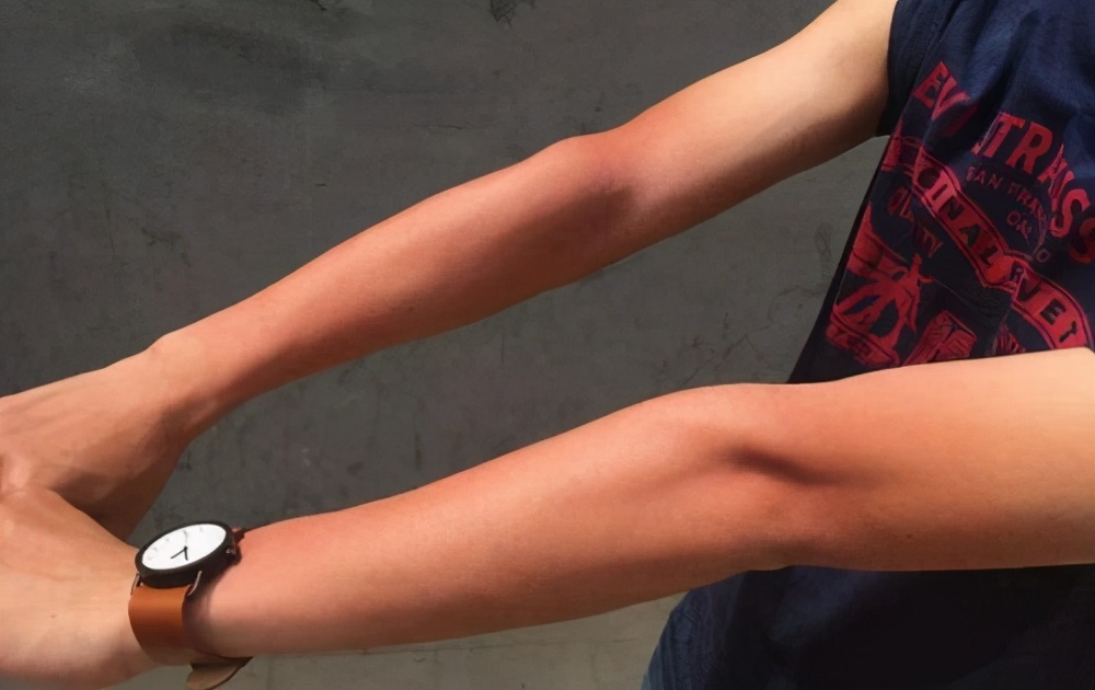 为什么有的人一晒就黑还不容易白,晒不黑一晒就黑