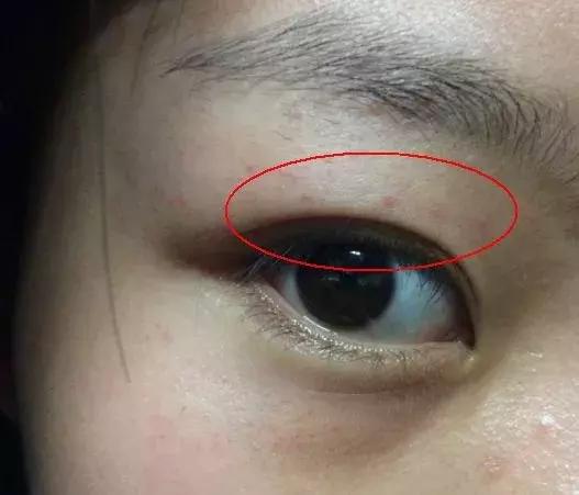 用theordinary过敏怎么办,theordinary烟酰胺没有刺痛感