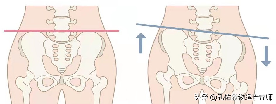 女性漏尿，究竟是怎么导致的？要如何治疗？一文给您详细解答