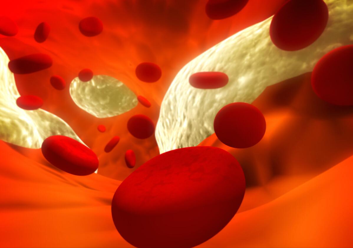 脑血管堵塞的5个前兆,脑血管堵塞的早期6个征兆