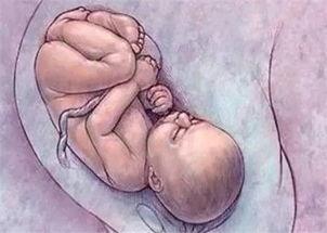 胎儿在几个月容易出现脐带绕颈,胎儿为什么会出现脐带绕颈的情况