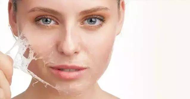 脸嘴唇干燥脱皮紧绷刺痛,冬季脸干燥脱皮紧绷刺痛