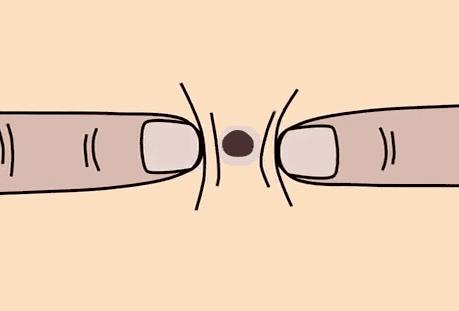 黑头拯救方法无成本,有黑头了该怎么有效去黑头