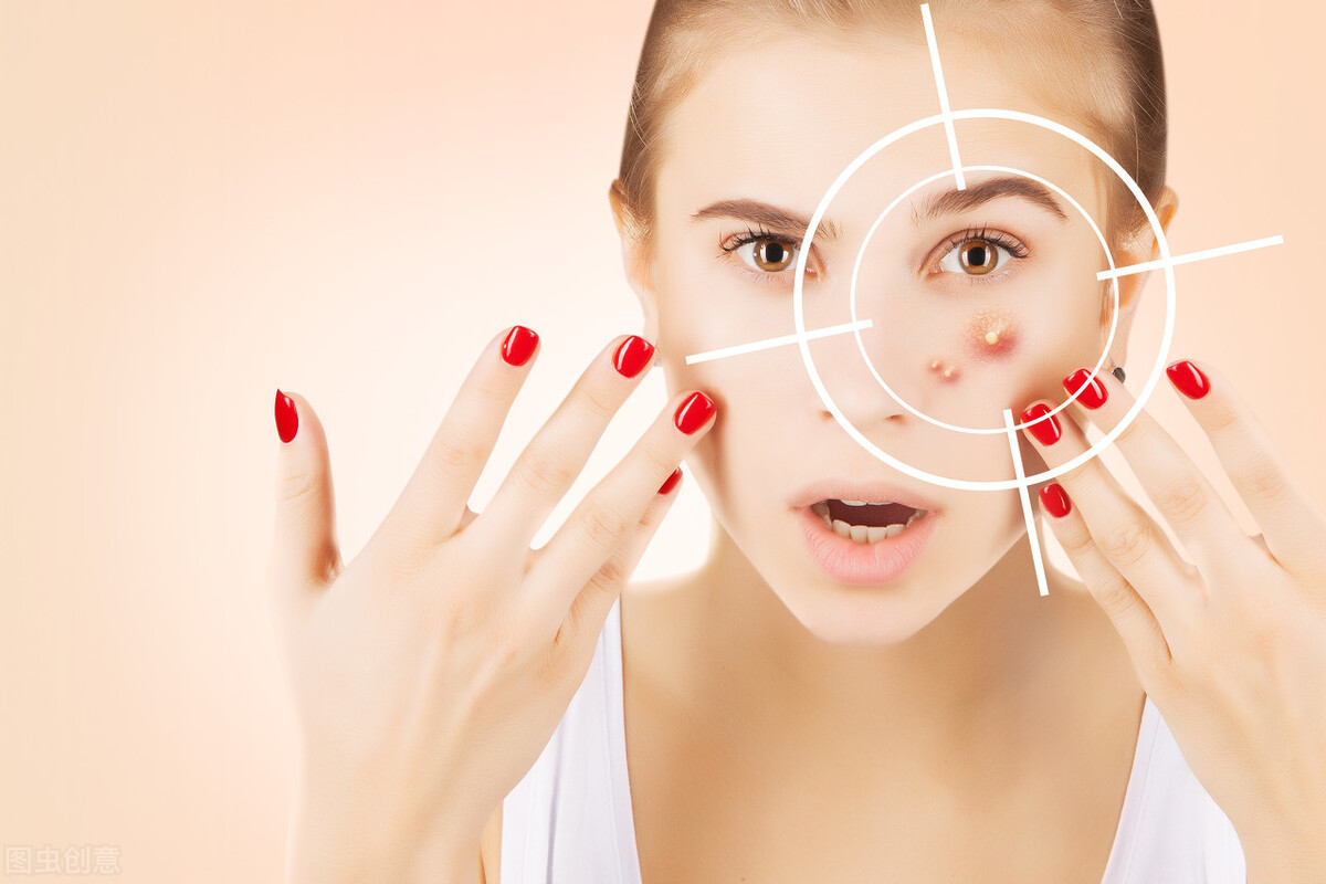 痘痘反反复复出现?预防复发,只要做好这4点