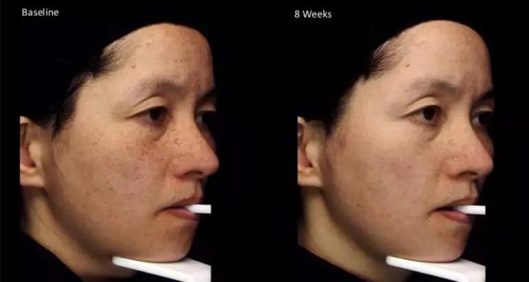 李小冉五官精致皮肤白皙透亮,70后女演员李小冉的高级搭配