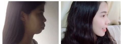 侧脸好看正脸好看么,侧脸比正脸好看的就是骨相美