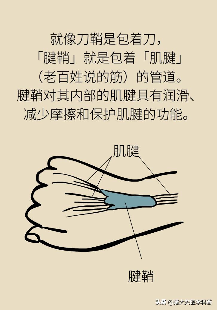 手腕长腱鞘囊肿,手腕上有个凸起的包腱鞘囊肿