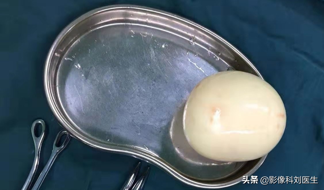 88岁的老大爷肚子痛是怎么回事,88岁大爷肚子痛