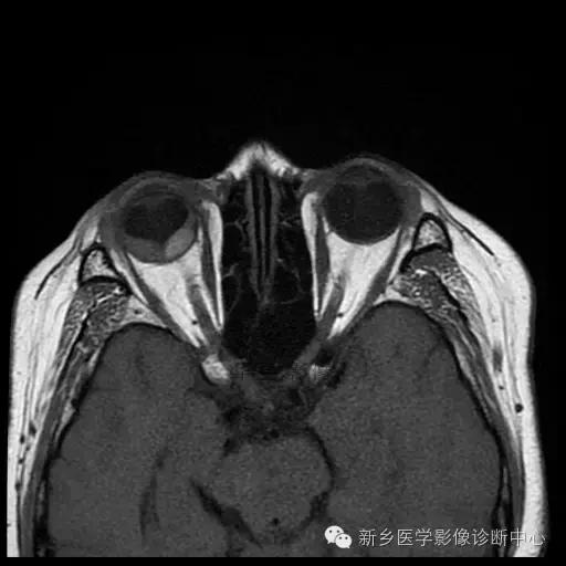 这些部位的黑色素瘤，您会诊断吗？