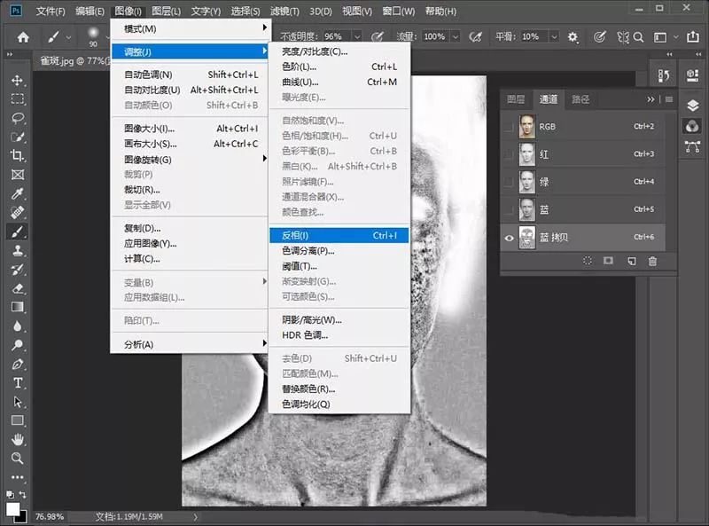 祛除脸部雀斑最有效的方法,有什么日常方法可以去除脸上雀斑