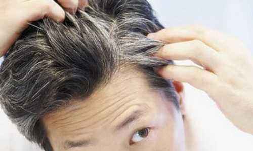 少白头头发白了有什么方法变黑,吃黑参可改善白发吗