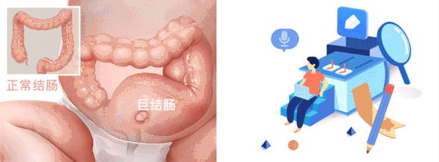 医学科普便秘,医生科普便秘吃这些药当心毁肠子