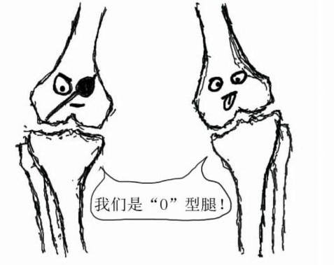 风湿类风湿关节痛广告原版,关节痛是痛风还是风湿
