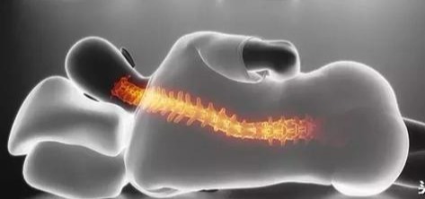 腰痛如何睡觉会缓解,睡觉睡久了腰痛是什么原因