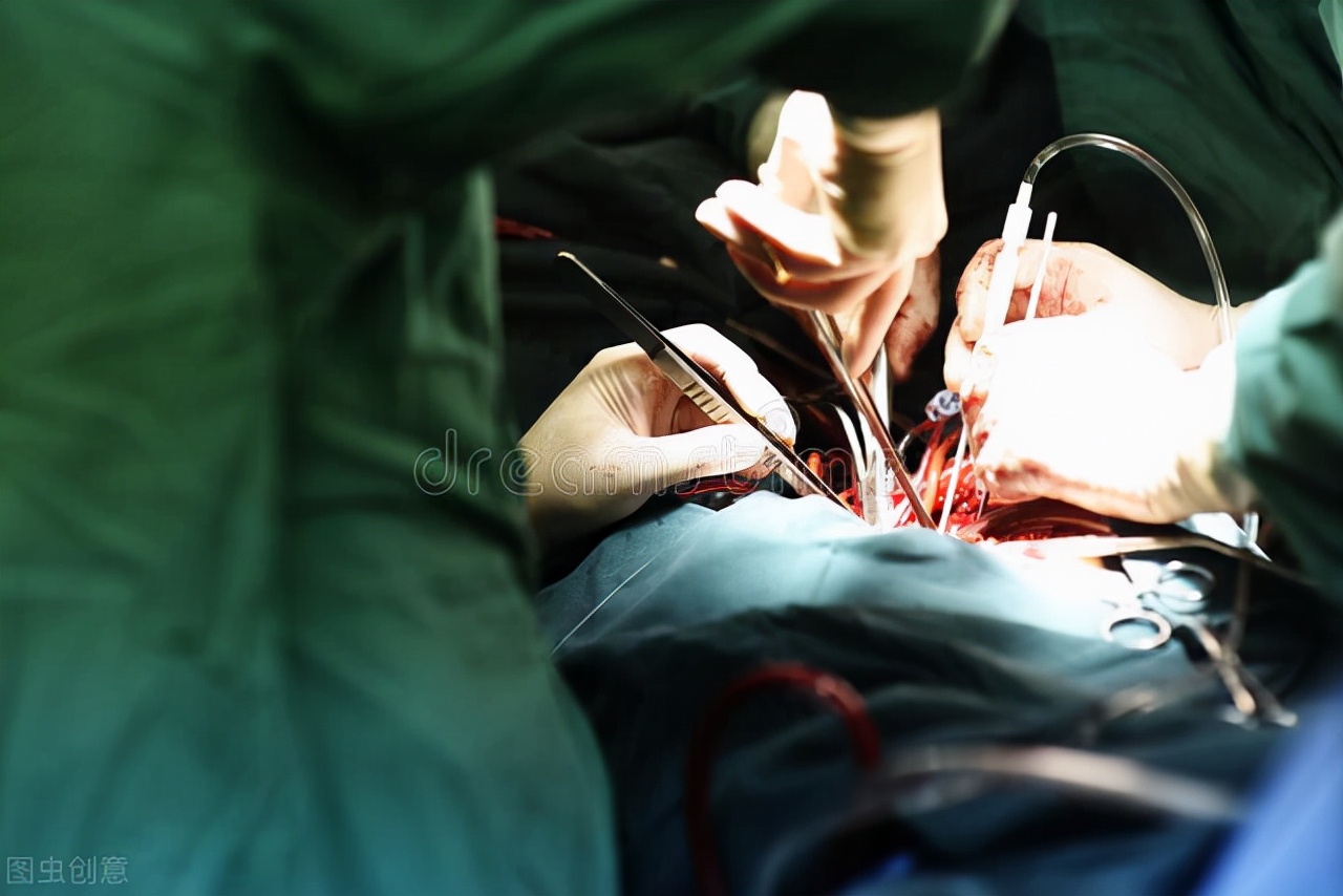 肝硬化腹水与心功能不全腹水,肝硬化顽固性腹水最有效方法