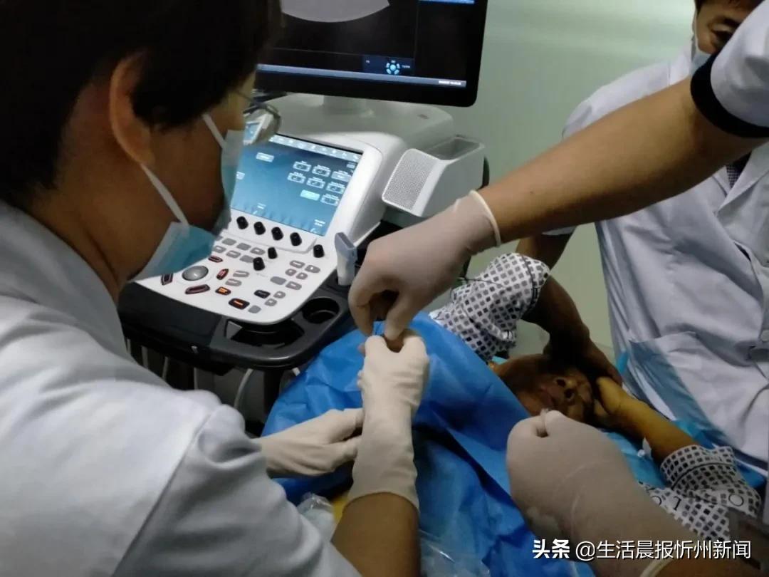 经皮肝穿刺胆道引流术县医院,经皮肝穿刺胆道引流术的并发症